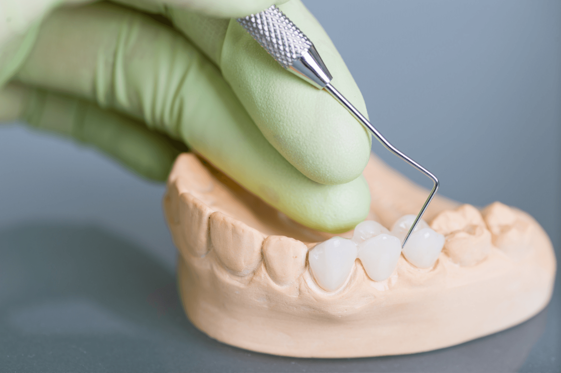 Protetică dentară fixă